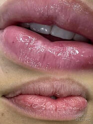 Hidratação profunda dos lábios com resultado imediato. Ideal para lábios ressecados, com fissuras, com aquelas pelinhas “chatas”.