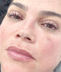 Lash Lifting procedimento realizado com seus cílios naturais proporcionando uma curvatura e projeção com durabilidade de até 2 meses. NÃO É EXTENSÃO DE CÍLIOS - NÃO TEM COLA - NÃO NECESSITA DE MANUTENÇÃO!